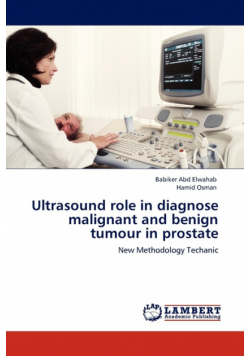 Ultrasound role in diagnose malignant and benign tumour in prostate