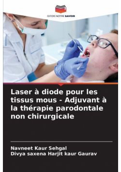 Laser à diode pour les tissus mous - Adjuvant à la thérapie parodontale non chirurgicale