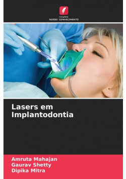 Lasers em Implantodontia