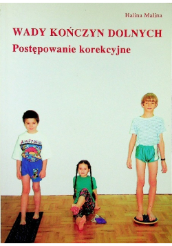 Wady kończyn dolnych