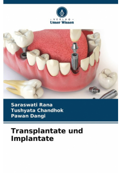 Transplantate und Implantate