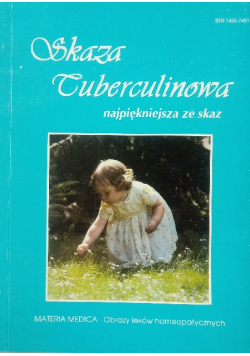 Skaza Tuberkulinowa najpiękniejsza ze skaz