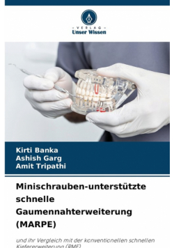 Minischrauben-unterstützte schnelle Gaumennahterweiterung (MARPE)