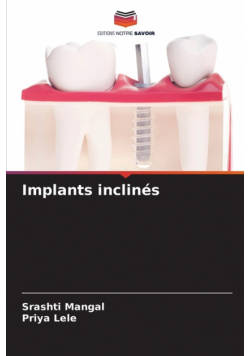 Implants inclinés