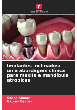 Implantes inclinados