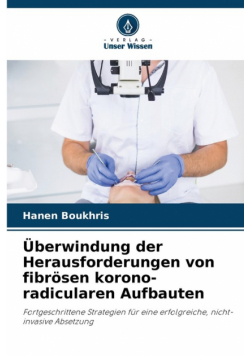 Überwindung der Herausforderungen von fibrösen korono-radicularen Aufbauten