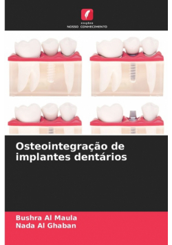 Osteointegração de implantes dentários