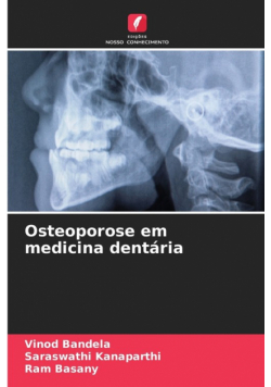 Osteoporose em medicina dentária