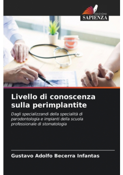 Livello di conoscenza sulla perimplantite