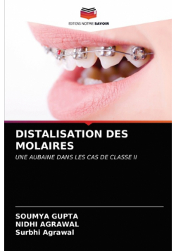 Distalisation Des Molaires