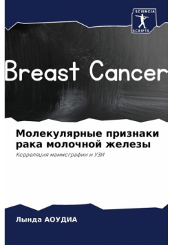 Молекулярные признаки рака молочной железы
