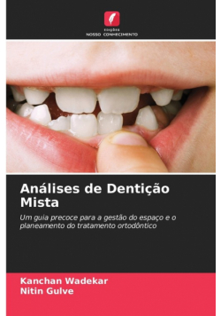 Análises de Dentição Mista