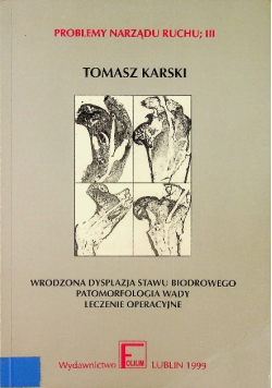 Wrodzona dysplazja stawu biodrowego patomorfologia wady leczenie operacyjne