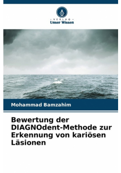 Bewertung der DIAGNOdent-Methode zur Erkennung von kariösen Läsionen