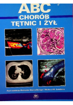 ABC chorób tętnic i żył