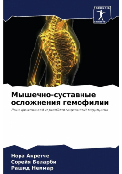 Мышечно-суставные осложнения гемофилии