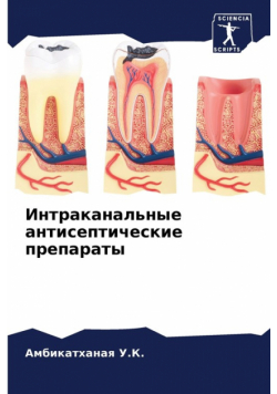 Интраканальные антисептические препараты