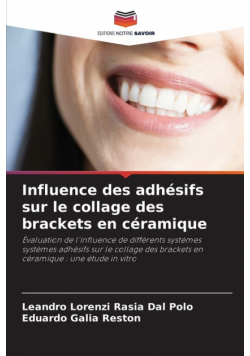 Influence des adhésifs sur le collage des brackets en céramique