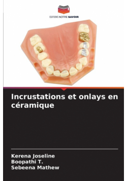 Incrustations et onlays en céramique