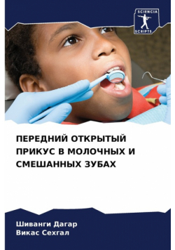 ПЕРЕДНИЙ ОТКРЫТЫЙ ПРИКУС В МОЛОЧНЫХ И СМЕШАННЫХ ЗУБАХ