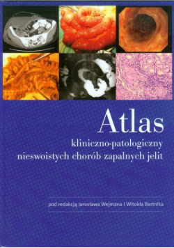 Atlas kliniczno patologiczny nieswoistych chorób zapalnych jelit