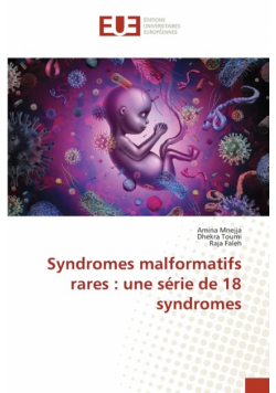 Syndromes malformatifs rares