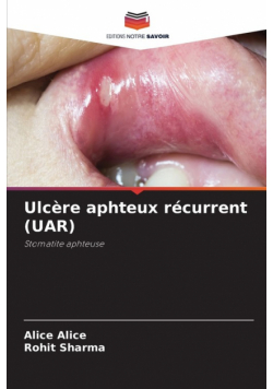Ulcère aphteux récurrent (UAR)