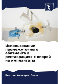 Использование промежуточного абатмента в реставрациях с опорой на имплантаты