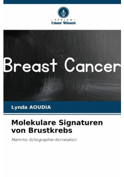 Molekulare Signaturen von Brustkrebs