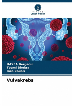 Vulvakrebs