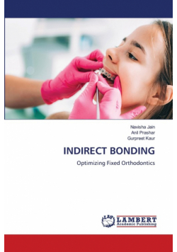 Indirect Bonding