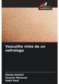 Vasculite vista da un nefrologo