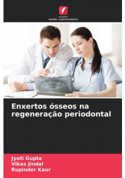 Enxertos ósseos na regeneração periodontal