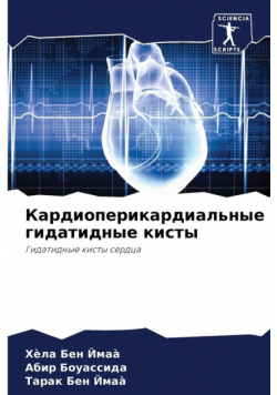 Кардиоперикардиальные гидатидные кисты