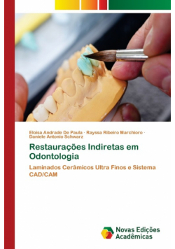 Restaurações Indiretas em Odontologia