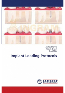 Implant Loading Protocols