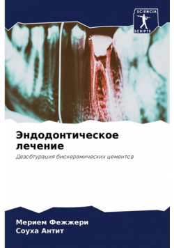 Эндодонтическое лечение