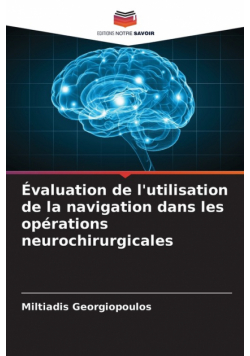 Évaluation de l'utilisation de la navigation dans les opérations neurochirurgicales