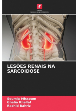 Lesões Renais Na Sarcoidose