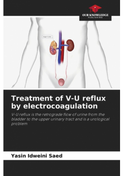 Treatment of V-U reflux by electrocoagulation