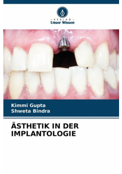 Ästhetik In Der Implantologie