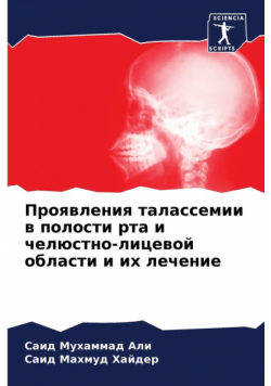 Проявления талассемии в полости рта и челюстно-лицевой области и их лечение