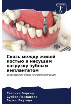 Связь между живой костью и несущим нагрузку зубным имплантатом