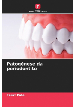 Patogénese da periodontite