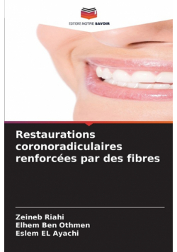 Restaurations coronoradiculaires renforcées par des fibres