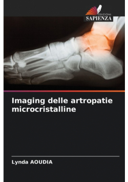 Imaging delle artropatie microcristalline