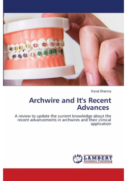 Archwire and It's Recent Advances