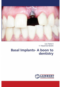 Basal Implants- A boon to dentistry