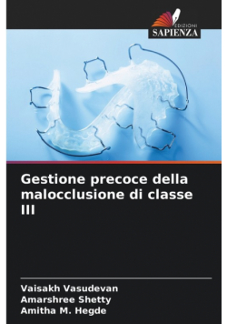 Gestione precoce della malocclusione di classe III