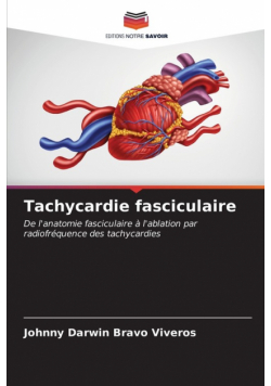 Tachycardie fasciculaire